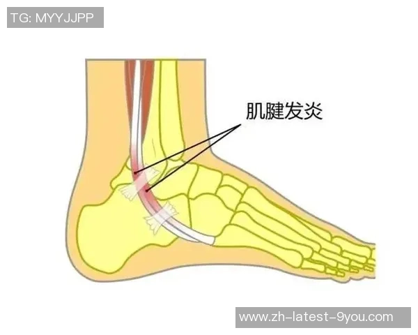 踢足球时脚踝疼痛的原因及预防措施详解